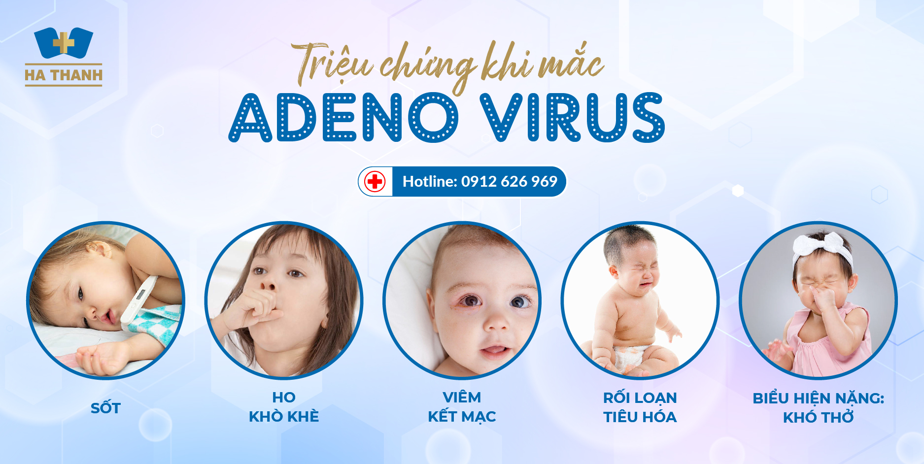 4. Điều trị bệnh sốt do Adenovirus