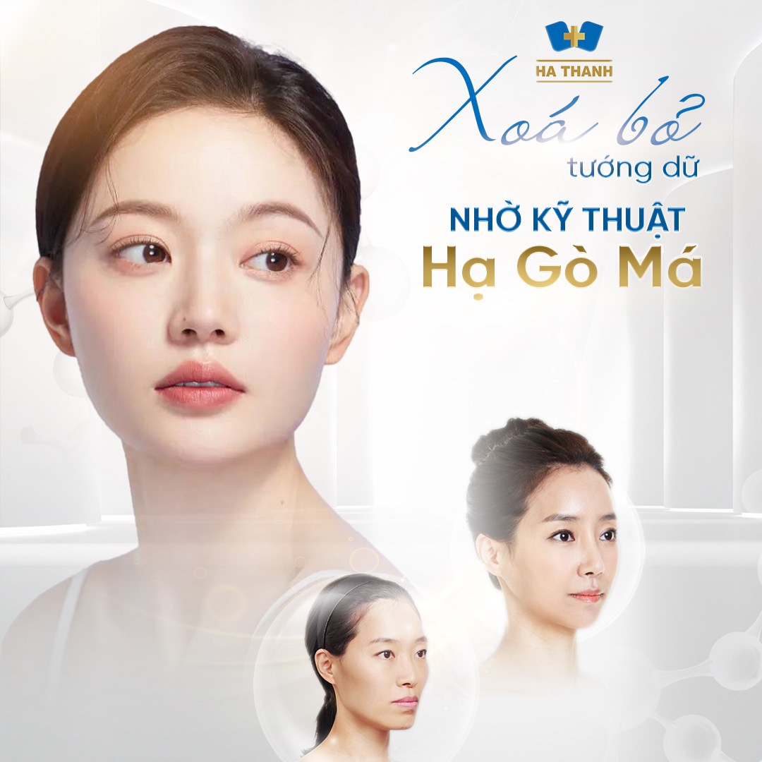Xóa bỏ tướng dữ - Nhờ kỹ thuật hạ gò má