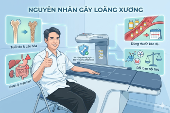 NGUYÊN NHÂN GÂY LOÃNG XƯƠNG