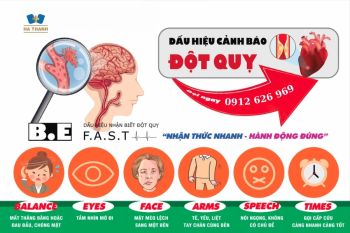 Nguyên Nhân Hàng Đầu Gây Đột Quỵ Và Cách Ngăn Ngừa Hiệu Quả