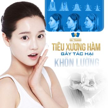 Tiêu xương hàm tác hại khôn lường